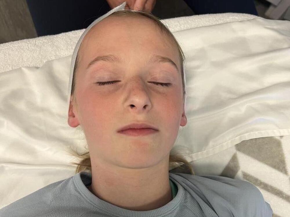 Hydrafacial For Teens Before & After Image